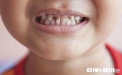 孩子长牙是一个重要的过程，要怎样保护才好呢