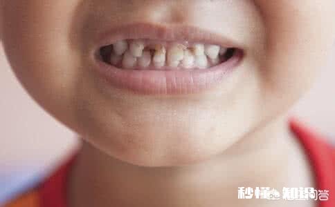 孩子长牙是一个重要的过程,要怎样保护才好呢