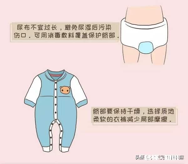 宝宝脐带什么时候才脱落平常该怎么护理宝宝的脐带呢