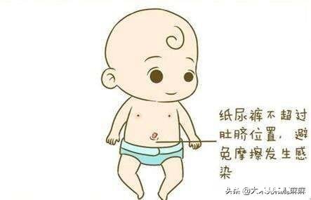 宝宝脐带什么时候才脱落平常该怎么护理宝宝的脐带呢