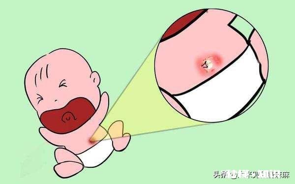 宝宝脐带什么时候才脱落平常该怎么护理宝宝的脐带呢