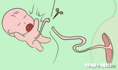 宝宝脐带什么时候才脱落平常该怎么护理宝宝的脐带呢