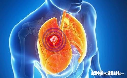 疫情过后，要不要预防疫情从国外再传回来