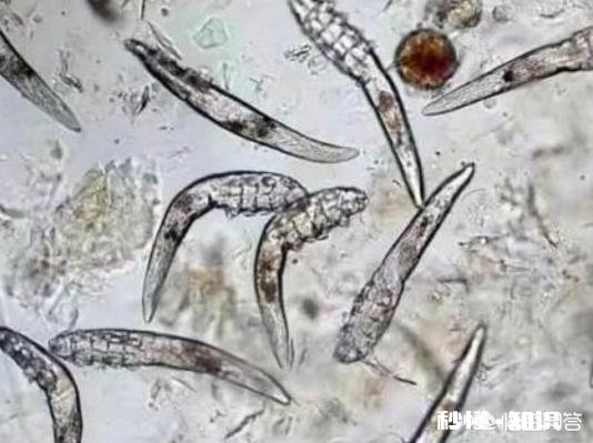 每次“挤痘痘”滋出的白色物质，是什么东西呢如何祛痘