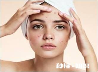 每次“挤痘痘”滋出的白色物质，是什么东西呢如何祛痘