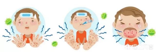 得过手足口病的儿童，以后还会得吗