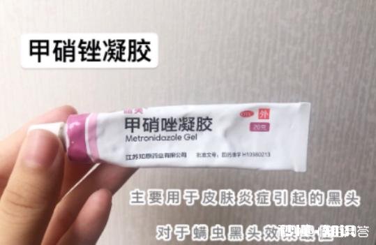 鼻子黑头反复，是什么原因导致的，又要如何去除黑头呢