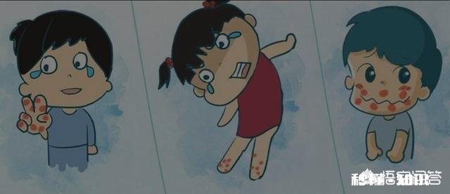 患有手足口病的孩子应该怎样在家治疗护理