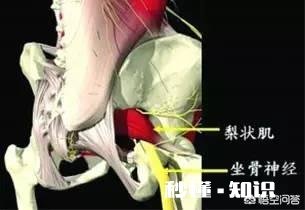 孕晚期的坐骨神经痛如何缓解