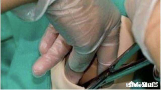 顺产的孕妈侧切是必须的吗十个产妇九个切，什么情况下会使用侧切呢