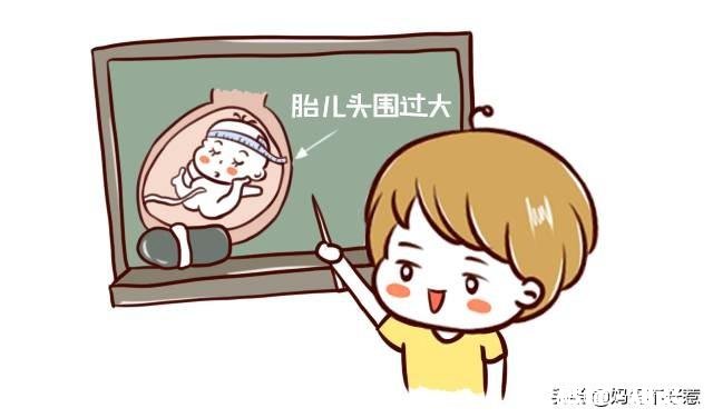 顺产的孕妈侧切是必须的吗十个产妇九个切，什么情况下会使用侧切呢