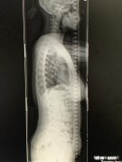 健身到底会不会阻碍长高希望能得到一个科学合理性的答案