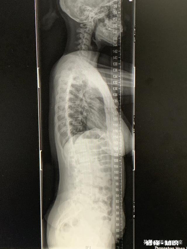 健身到底会不会阻碍长高希望能得到一个科学合理性的答案