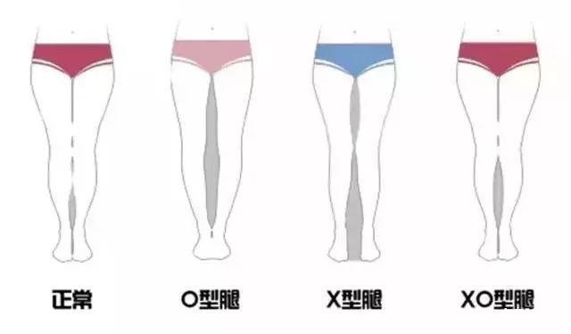 练瑜伽可以直腿吗