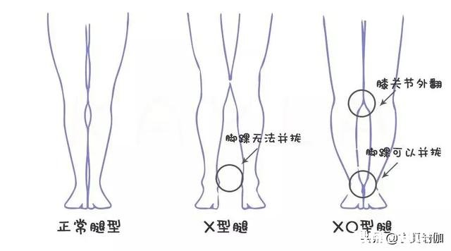 练瑜伽可以直腿吗