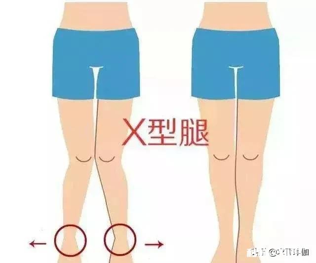 练瑜伽可以直腿吗