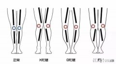 练瑜伽可以直腿吗