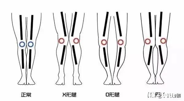 练瑜伽可以直腿吗
