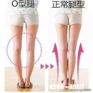 练瑜伽可以直腿吗