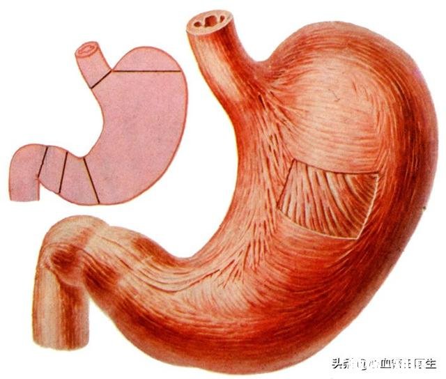 阿司匹林可以像保健品一样经常吃吗,为什么