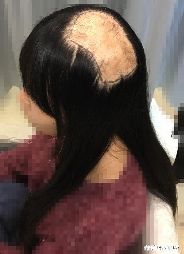 请问假发在哪里买