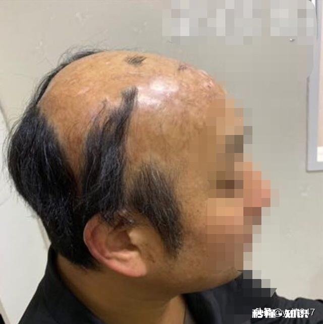 请问假发在哪里买