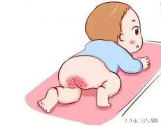 宝宝红屁屁需要怎么护理呢