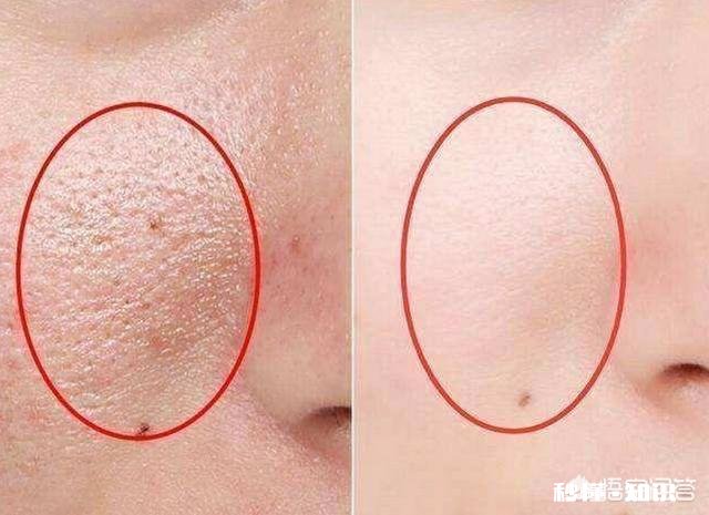 如何拯救一张长期化妆的脸