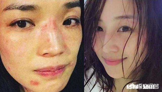 如何拯救一张长期化妆的脸