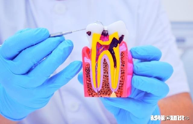 蛀牙怎么办