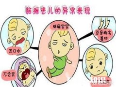 脑瘫患者的典型症状有哪些