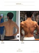 身体严重缺蛋白质，怎么补