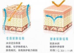 皮肤干燥怎么补水最快