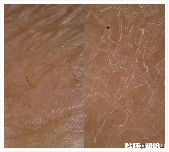 干性皮肤用哪种化妆品补水效果会不错