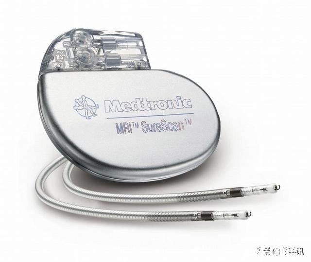 锂电池是由哪些组成的它与别种电池对比具有哪些优势