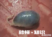 生黄豆和猪苦胆能治疗咳嗽吗
