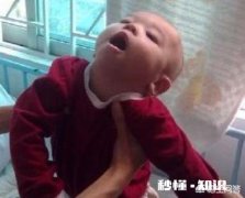 怎样确诊是否脑瘫