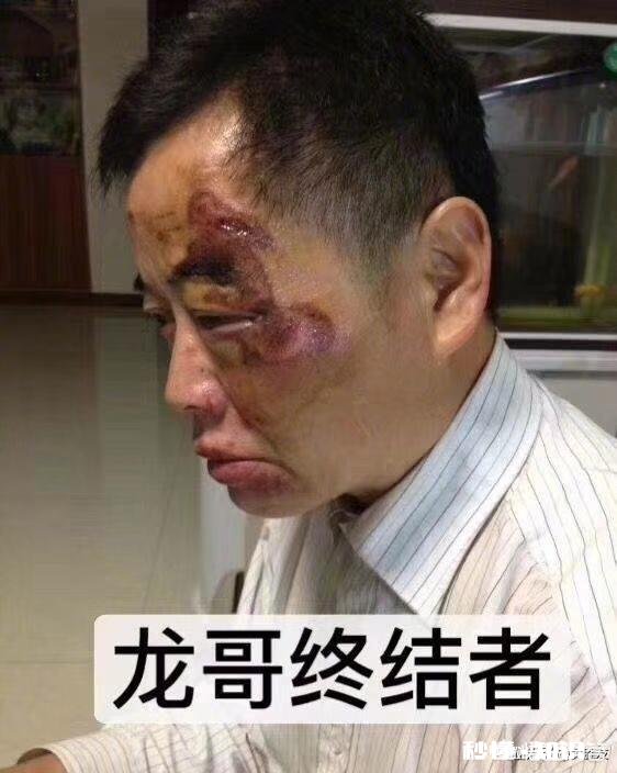 昆山砍人事件中，宝马车里的随行人员要不要受到惩罚呢你怎么看