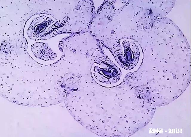 有什么适合孩子玩的益智玩具