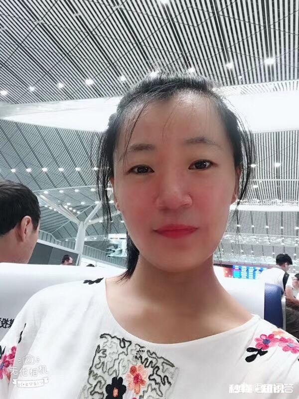 皮肤有红血丝而且容易长痘的人，用什么护肤品比较好