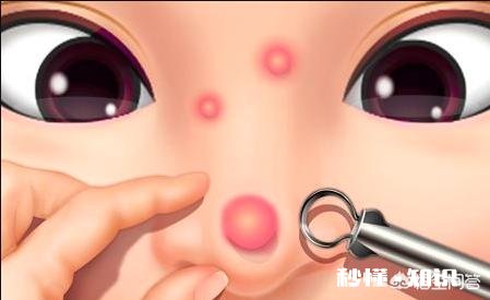 女生会把自己长痘痘的图片发朋友圈吗