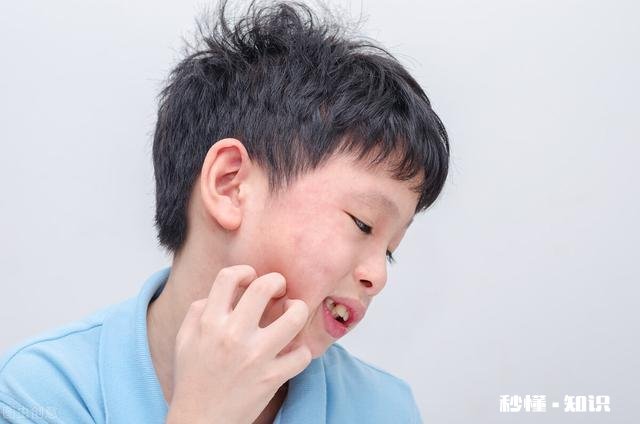 荨麻疹可怕吗