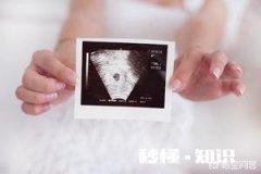 产科医生提醒：坐月子是减脂黄金期，如何把握时机暴瘦25斤