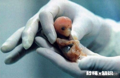 打胎会有哪些后遗症