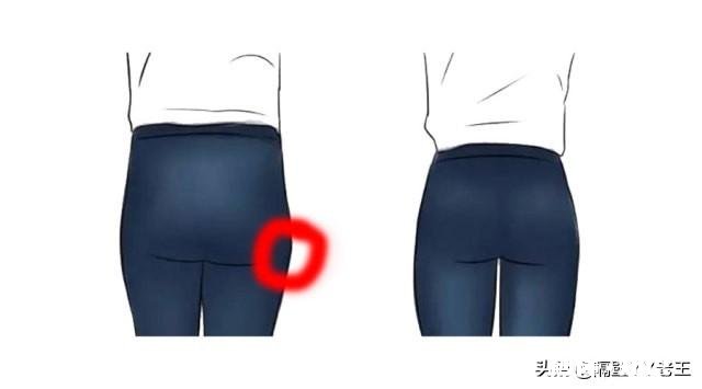 假胯宽适合什么类型的裤子