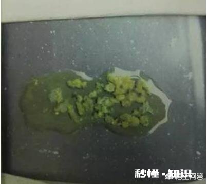 鸽子粪便像鸡蛋清，里边有像火柴棍一样的粪便是怎么回事