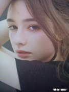 头汗特多正常吗