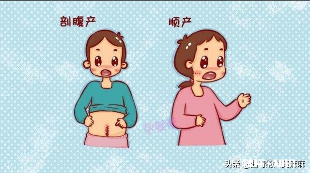 剖腹产和顺产出生的婴儿有什么不同
