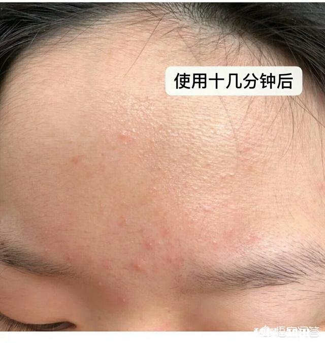 十八岁软妹，干性敏感肌，有什么适合的护肤品推荐