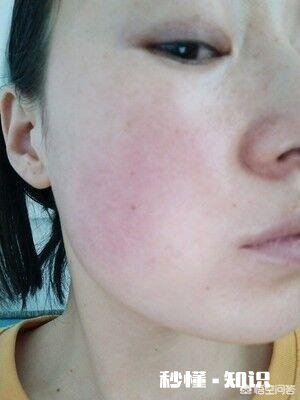 十八岁软妹，干性敏感肌，有什么适合的护肤品推荐